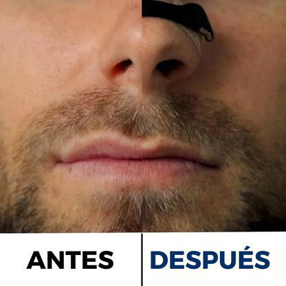 AirMax™ - Kit de tiras nasales magnéticas